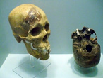В Музее медицины в Мехико — черепа в витрине