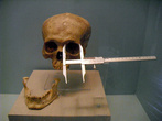 В Музее медицины в Мехико — череп