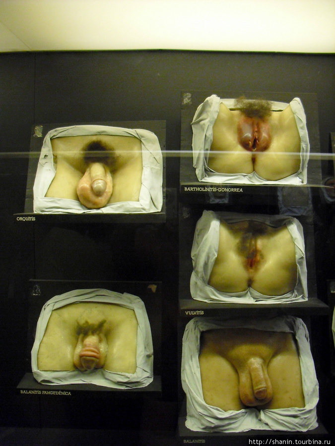 В Музее медицины в Мехико — выставка мужских половых органов Мехико, Мексика