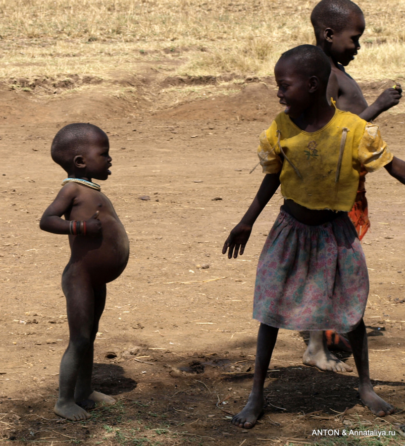 У многих вздутые животы от недоедания и несбалансированного питания Заповедник Пиан-Упе, Уганда