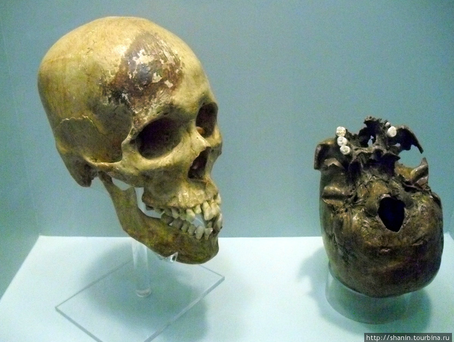 В Музее медицины в Мехико — черепа в витрине Мехико, Мексика