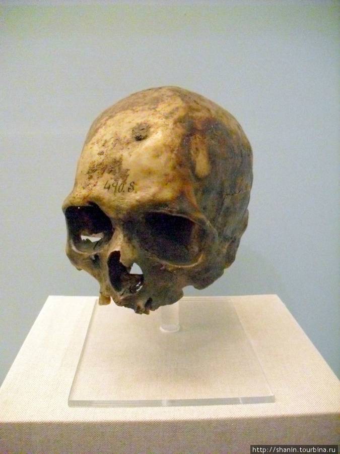 В Музее медицины в Мехико — череп в витрине Мехико, Мексика