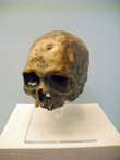 В Музее медицины в Мехико — череп в витрине