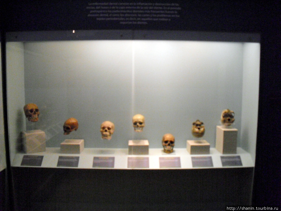 В Музее медицины в Мехико — черепа Мехико, Мексика