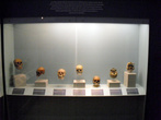 В Музее медицины в Мехико — черепа
