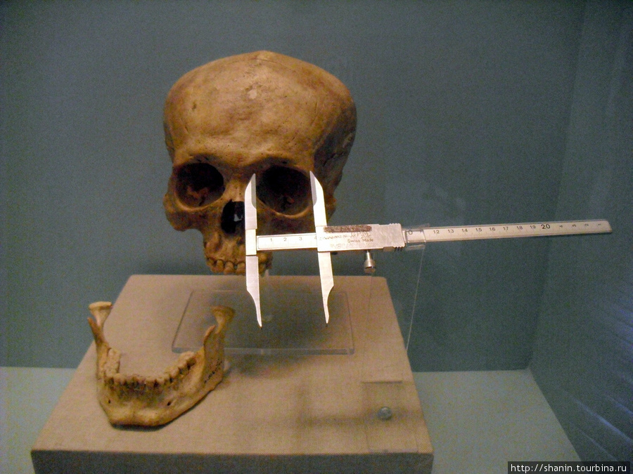 В Музее медицины в Мехико — череп Мехико, Мексика