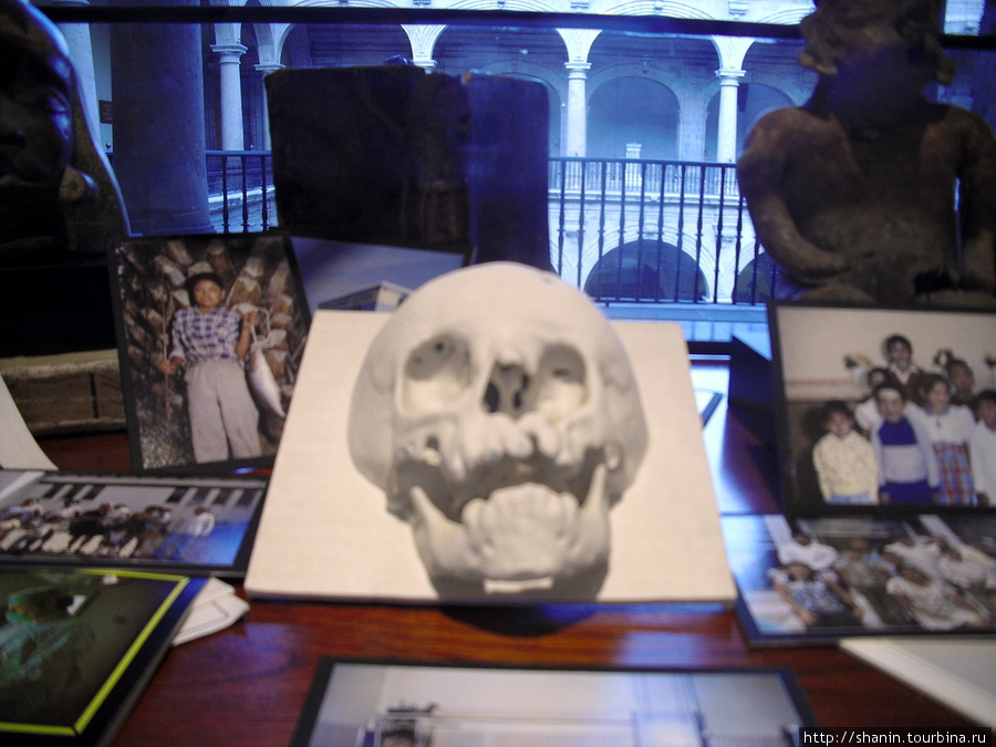 В Музее медицины в Мехико — череп в витрине Мехико, Мексика